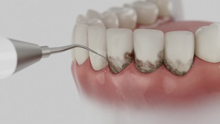 Reliable Dental contractor in Absecon, NJ by Smile Center Dentistry